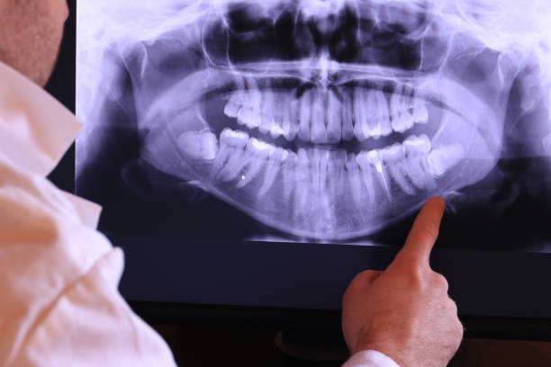 Best Emergency Dental Services for Seniors in Monmouth, IL