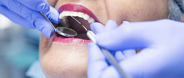 Best Emergency Root Canal Treatment in Monmouth, IL